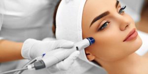 Microdermabrasion