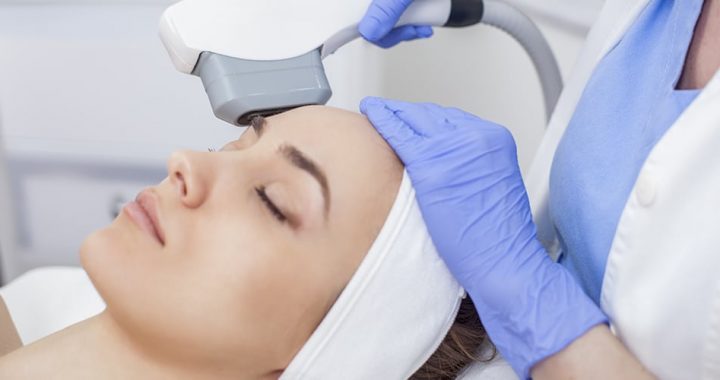 Photofacial Treatment in Lahore , Photofacial Treatment in Pakistan