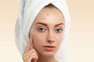 Acne, Skin treatment in cosmetique clinic lahore pakistan