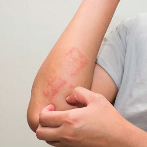 best skin specialist in lahore