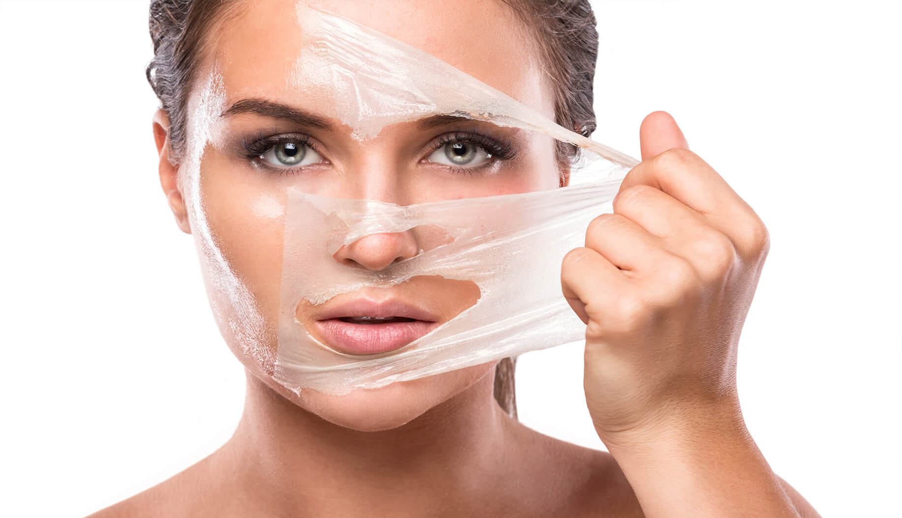 Chemical Peels Treatment