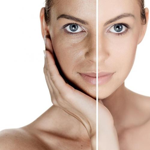 Dull-Skin Treatment in Lahore , Dull-Skin Treatment in Pakistan