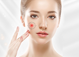 Laser-Skin-Toning in Lahore -Laser-Skin-Toning in Pakistan