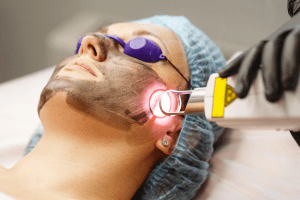 melasma tr