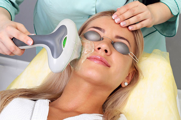 Photofacial treatment in Lahore , Photofacial treatment in Pakistan