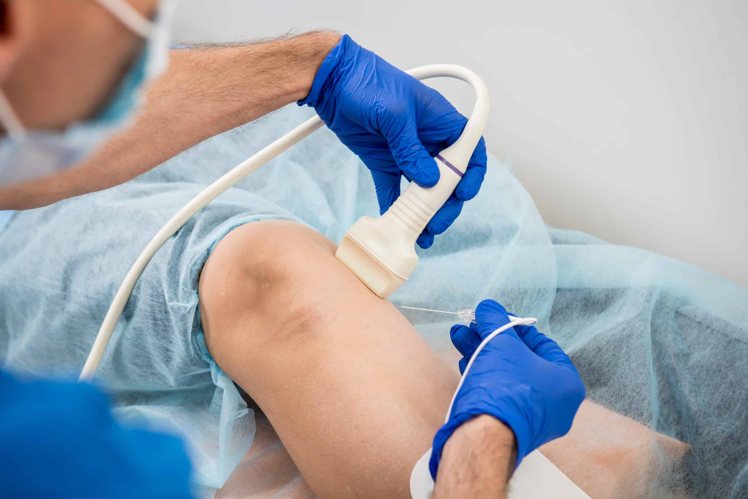 Radiofrequency ablation 500×500 aser treatment for varicose veins in Lahore, aser treatment for leg veins, best skin specialist, best dermatologist in pakistan