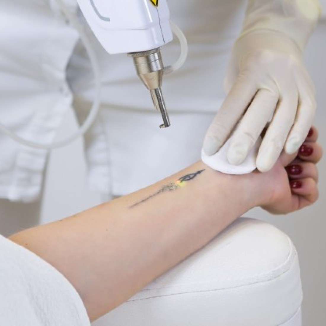 Tattoo removal treatment in lahore best laser clinic in lahore, best tattoo removal treatment in lahore