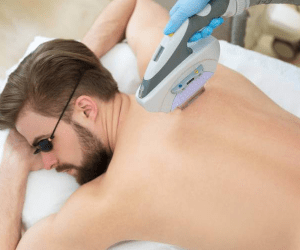 best laser hair removal treatment in lahore