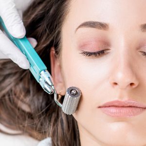 microneedling treatment in Lahore